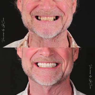 Slider image (1) Dr. Care Implant Clinic